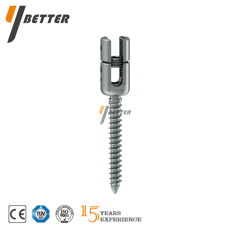 多軸可折斷椎弓根釘 I 型