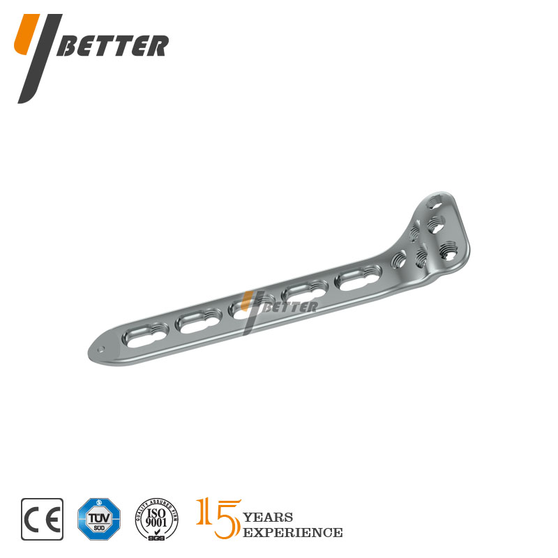 橈骨小頭鎖定板