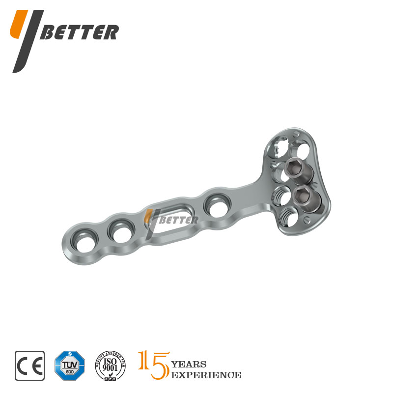 Y-DVR橈骨遠端掌側接骨板