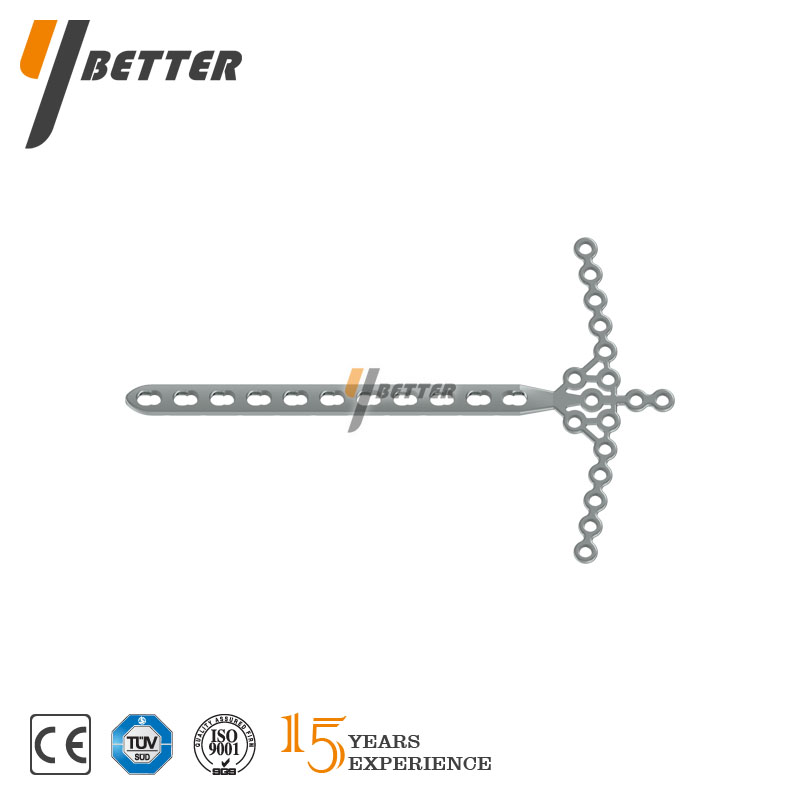 脛骨遠端海鷗形鎖定板