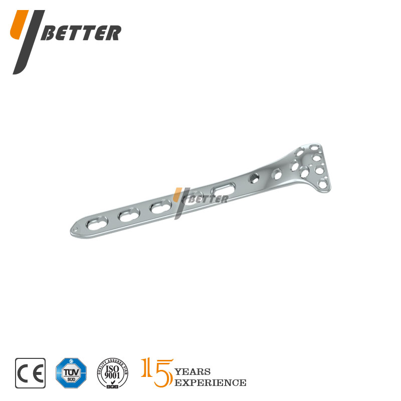 脛骨平臺外側鎖定板