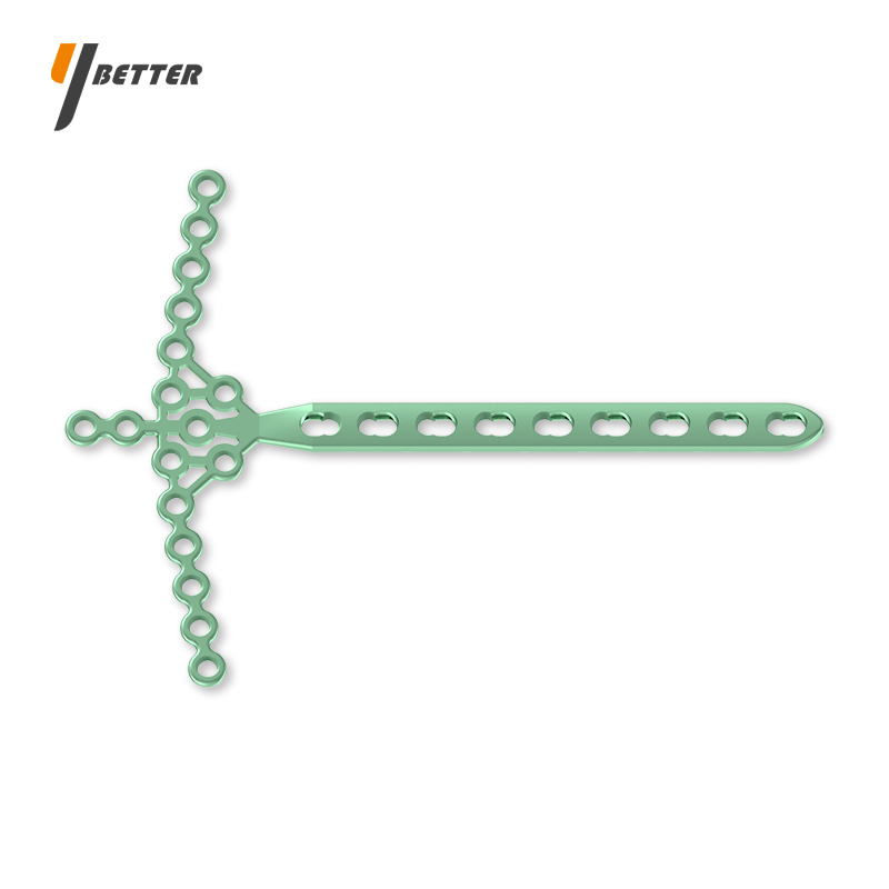 脛骨遠端海鷗形鎖定板