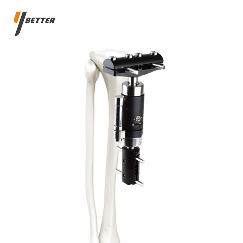 微動力支架（脛骨近端）