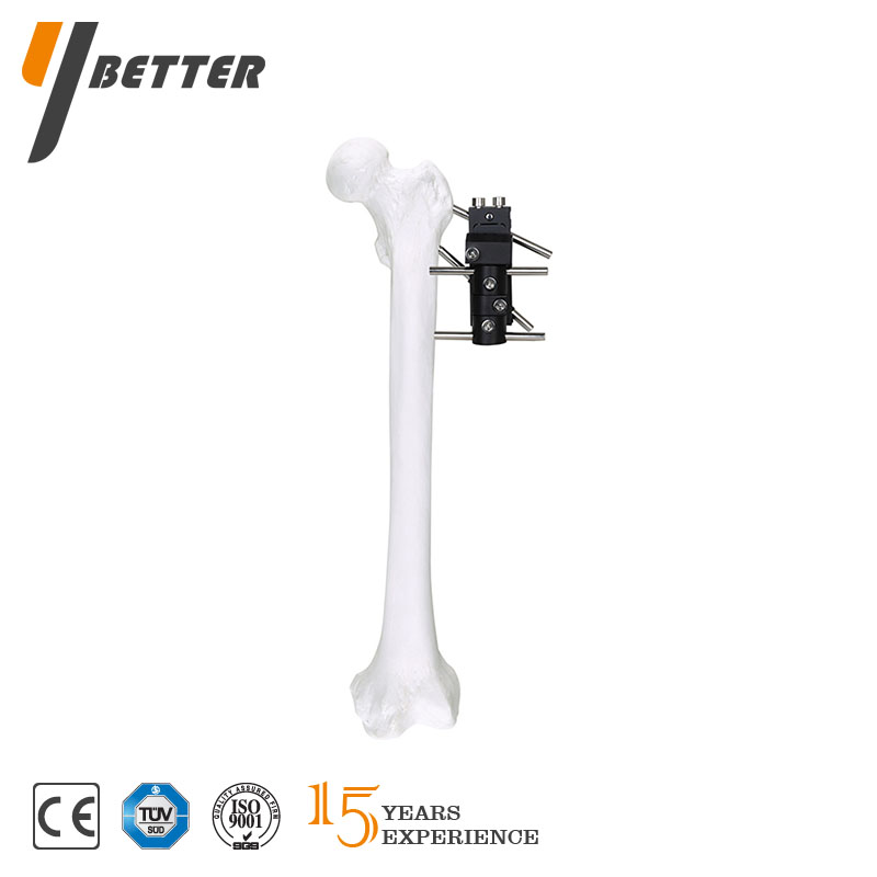 股骨近端骨折支架