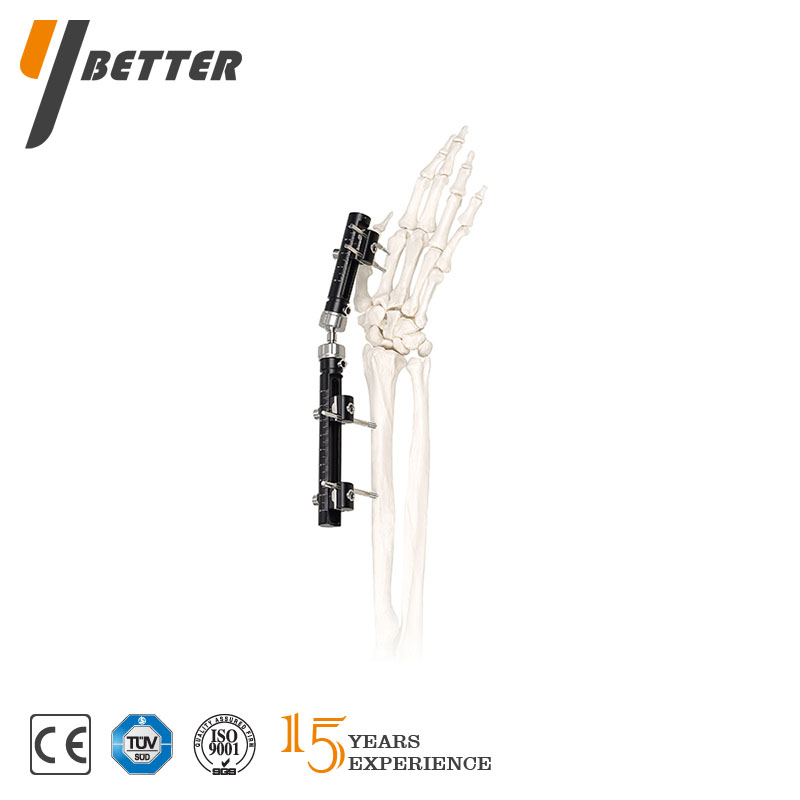 單側一體式外固定系統