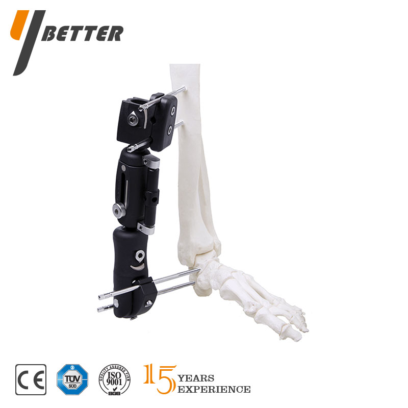 脛骨遠端支架（大號、小號）