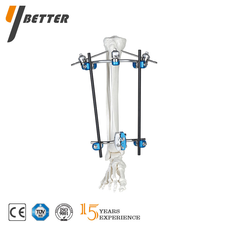 組合式外固定系統